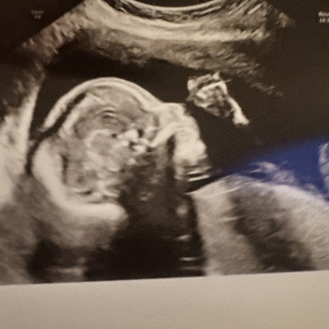 Photo shared by Breanna for their Babylist baby registry.