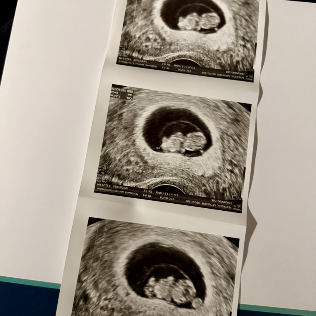 Photo shared by Katie for their Babylist baby registry.