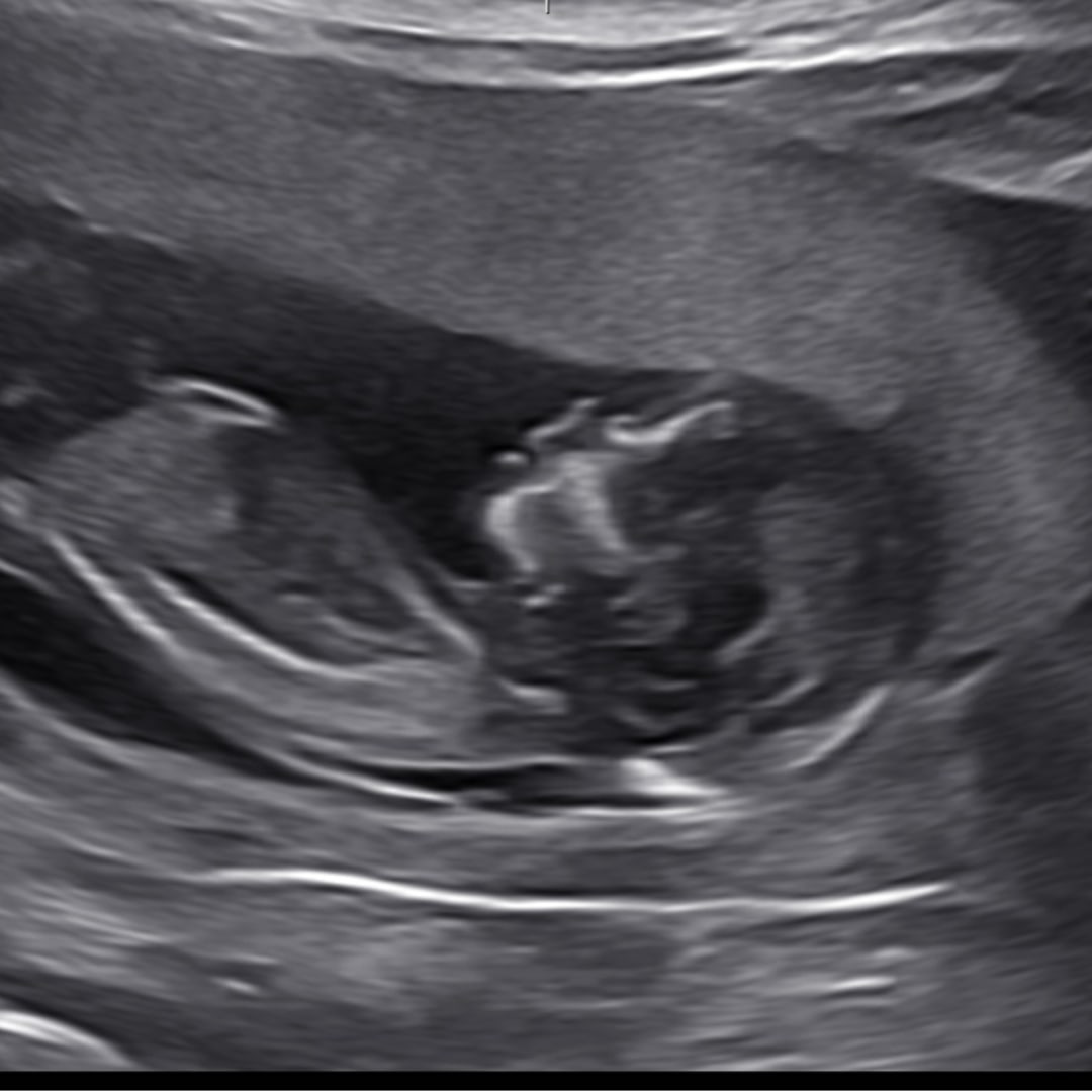 Photo shared by Jill for their Babylist baby registry.