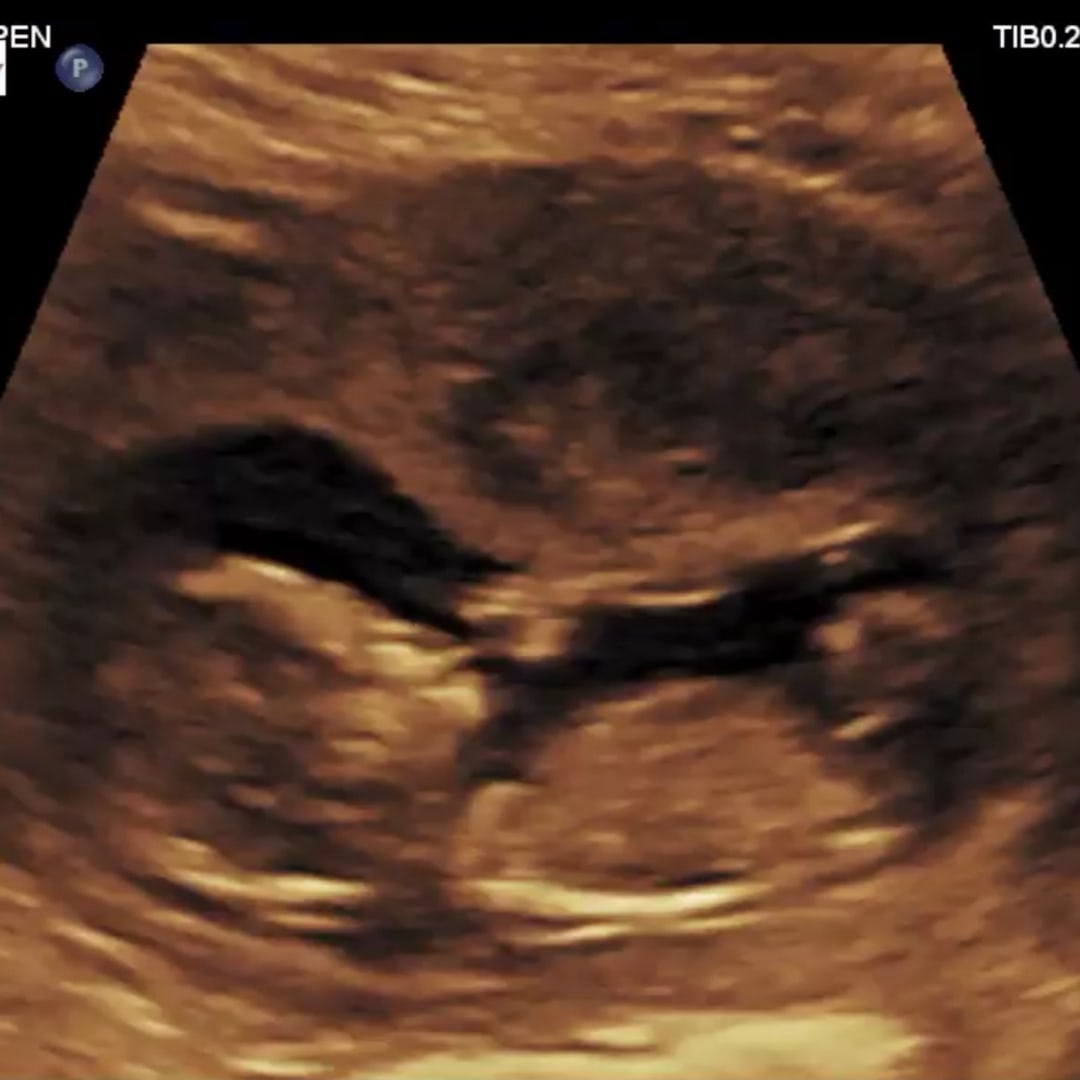 Photo shared by Leslie for their Babylist baby registry.