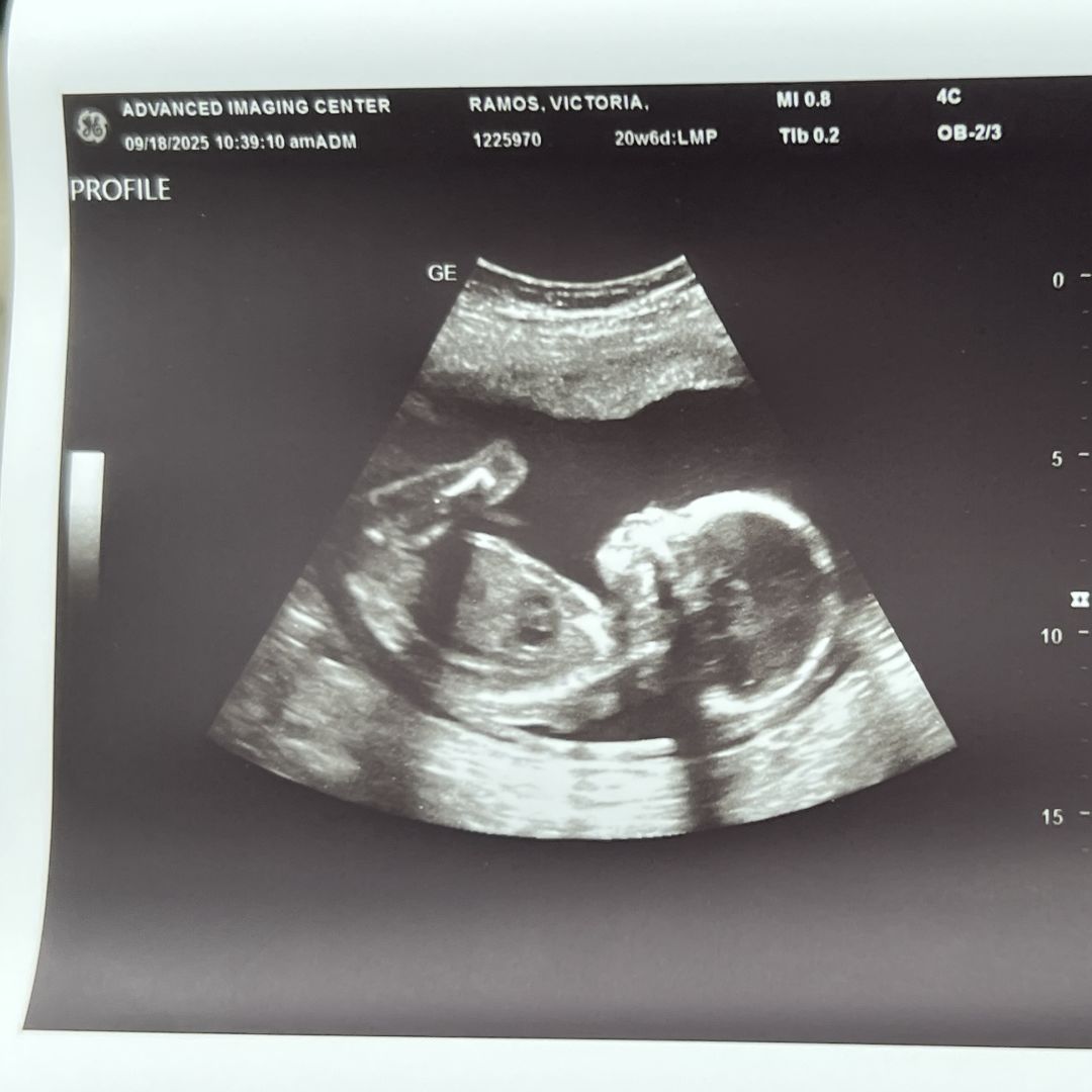 Photo shared by Victoria for their Babylist baby registry.