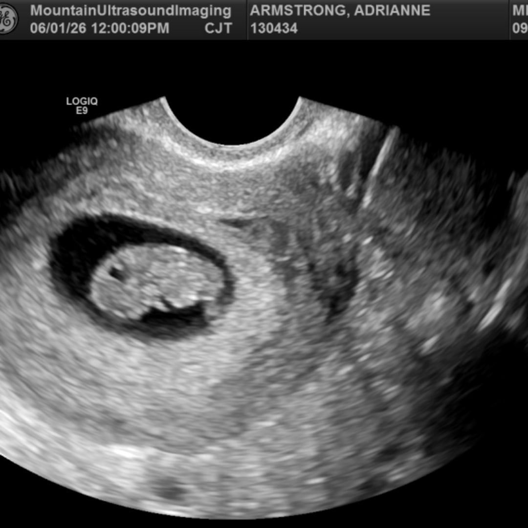 Photo shared by Adrianne for their Babylist baby registry.