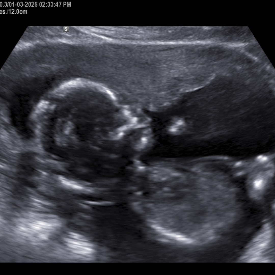 Photo shared by Hildamay for their Babylist baby registry.