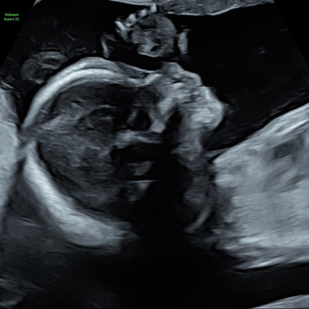 Photo shared by Annie for their Babylist baby registry.