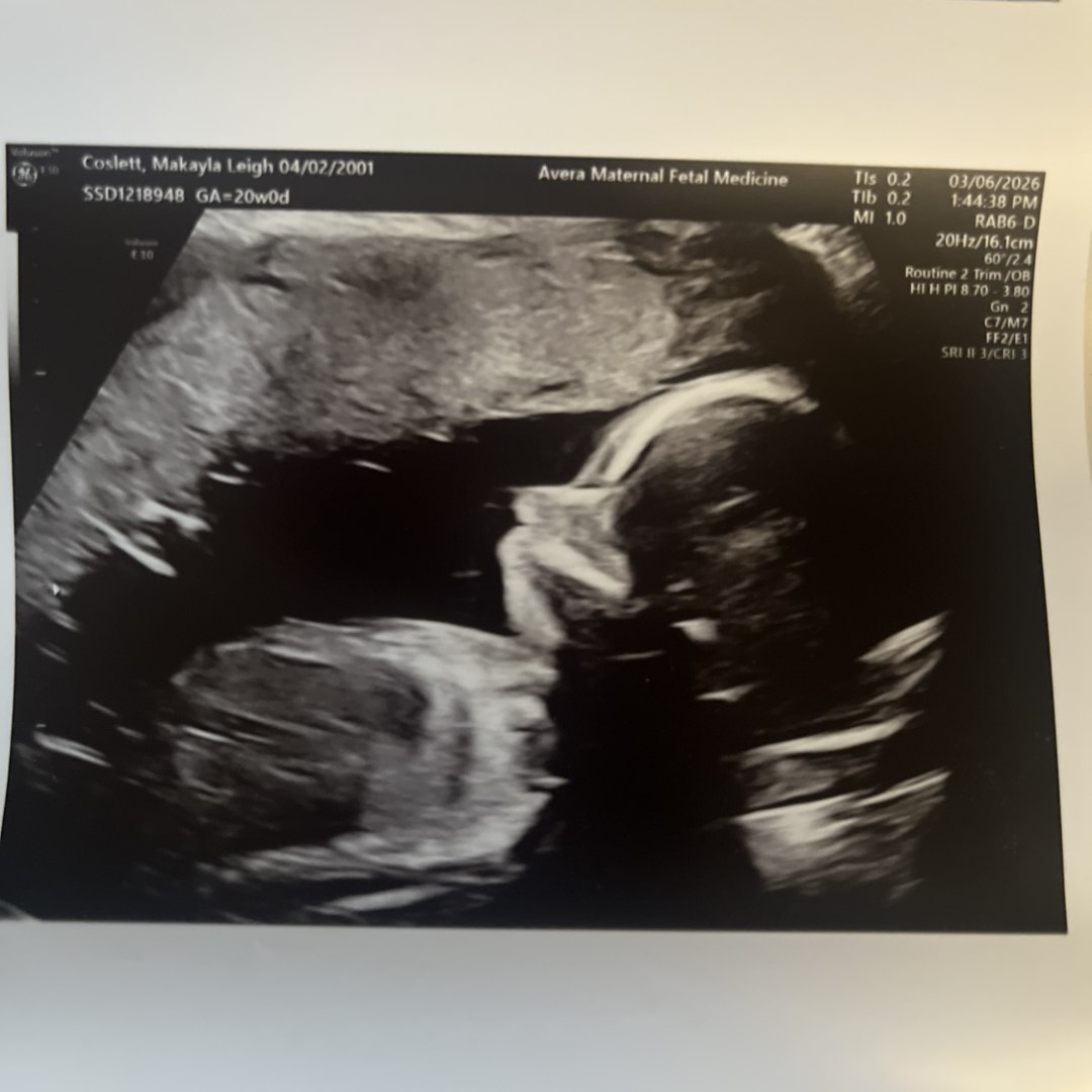 Photo shared by Makayla for their Babylist baby registry.