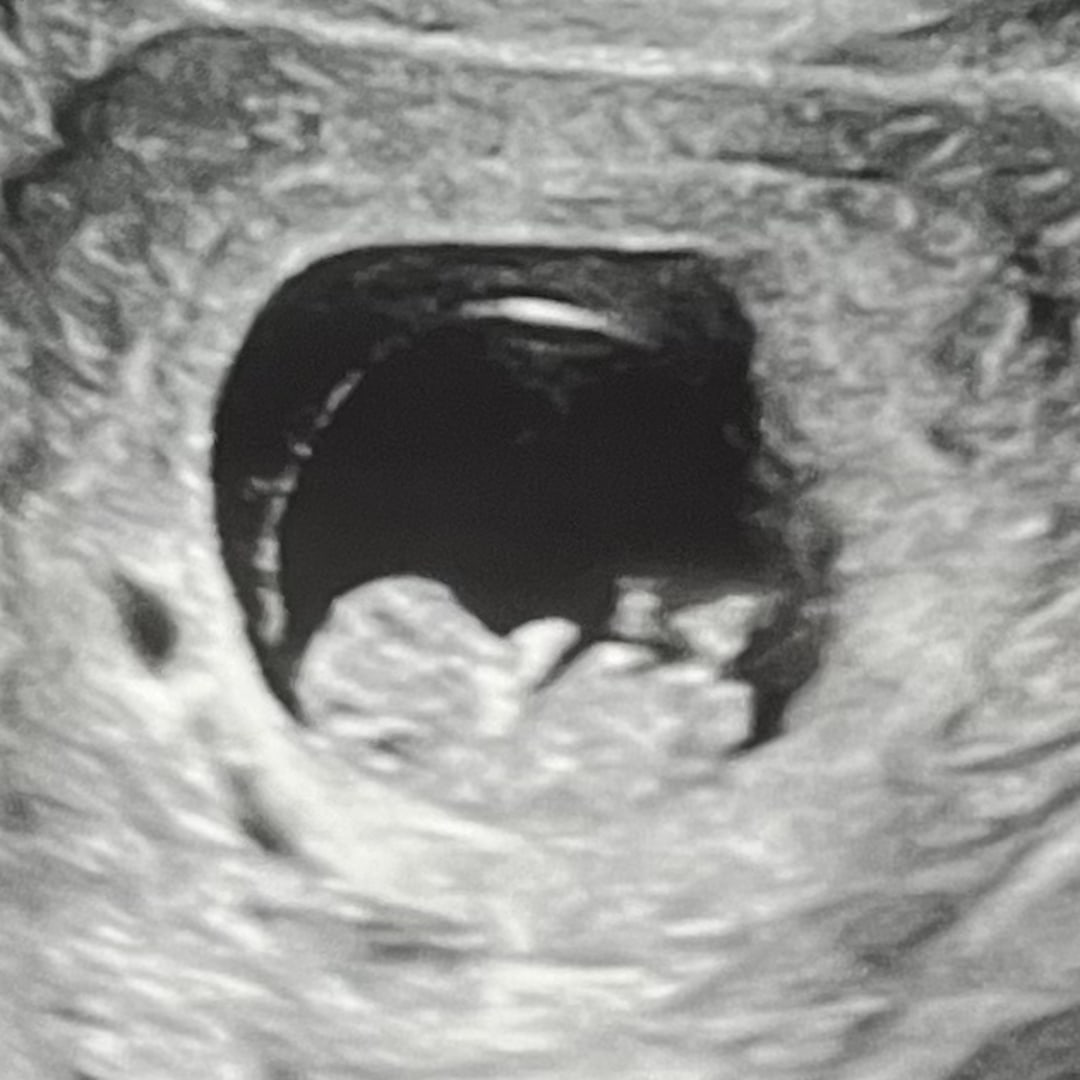 Photo shared by Mercedez for their Babylist baby registry.