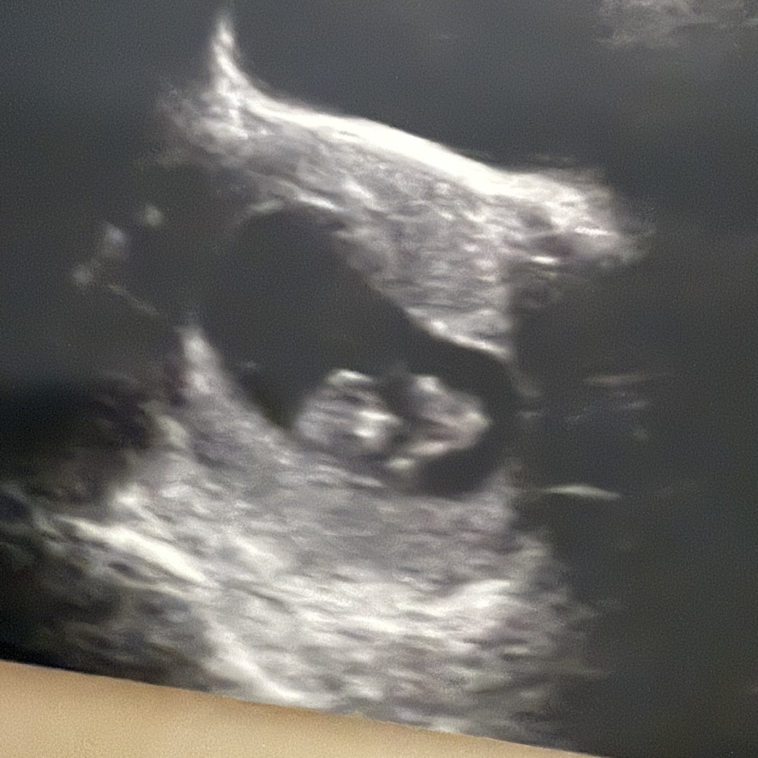 Photo shared by Vanessa for their Babylist baby registry.