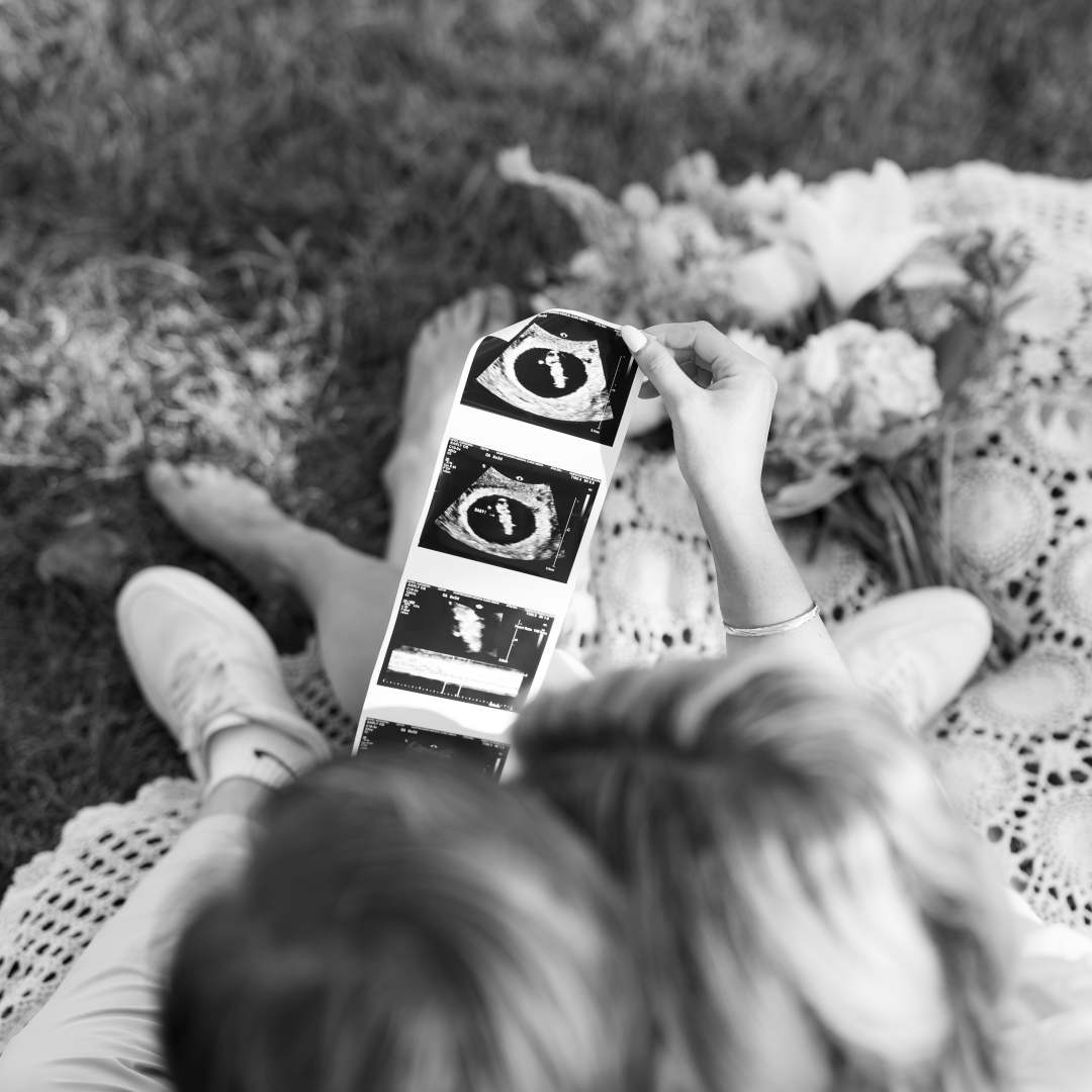Photo shared by Allie for their Babylist baby registry.