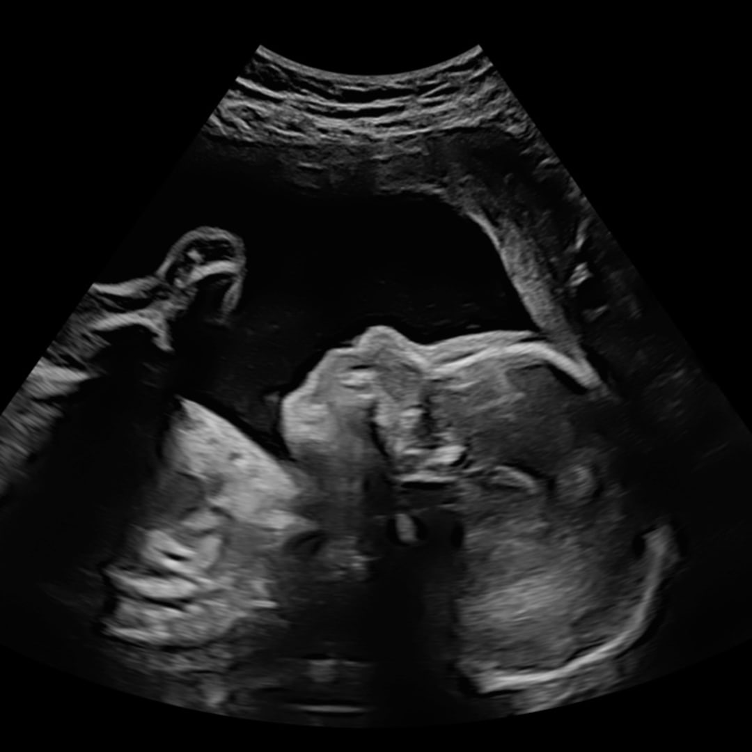 Photo shared by Kayla for their Babylist baby registry.