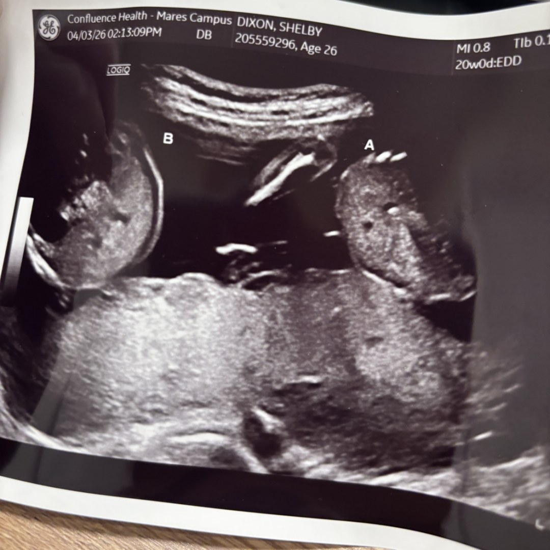 Photo shared by Shelby for their Babylist baby registry.