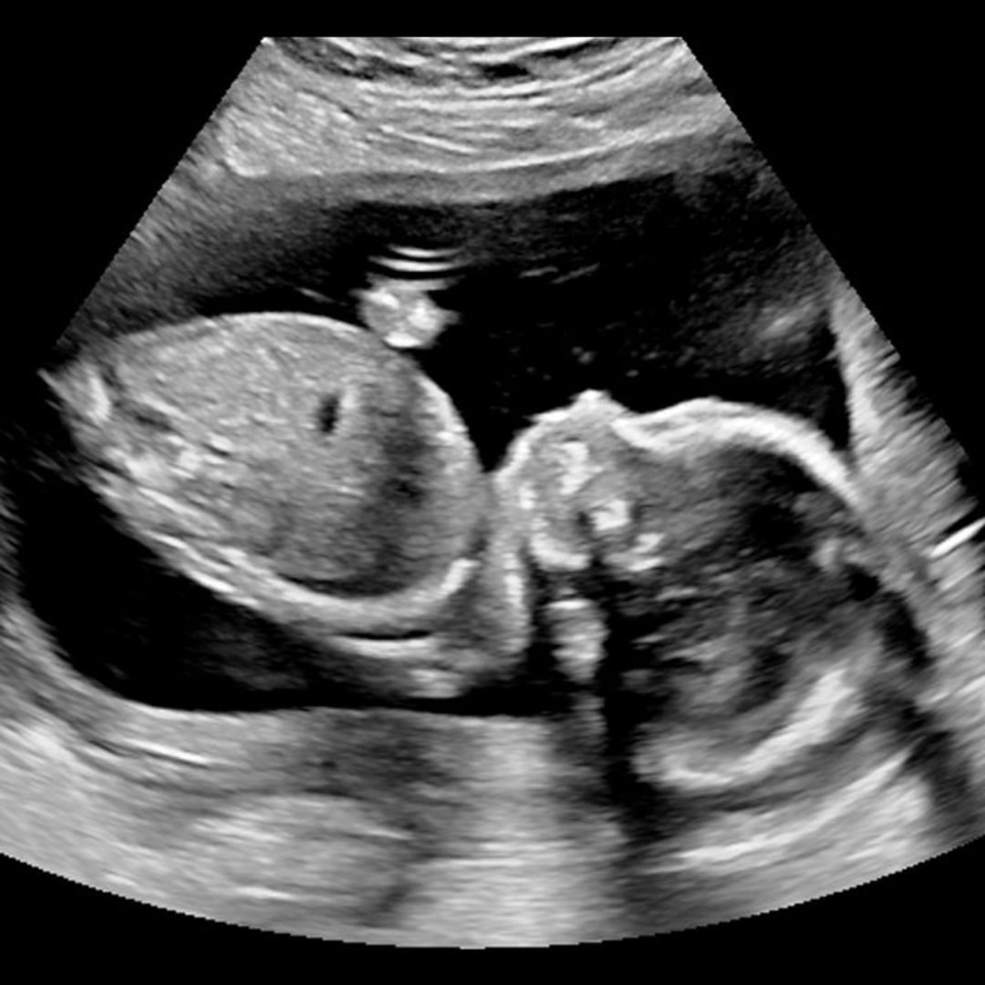 Photo shared by Erin for their Babylist baby registry.