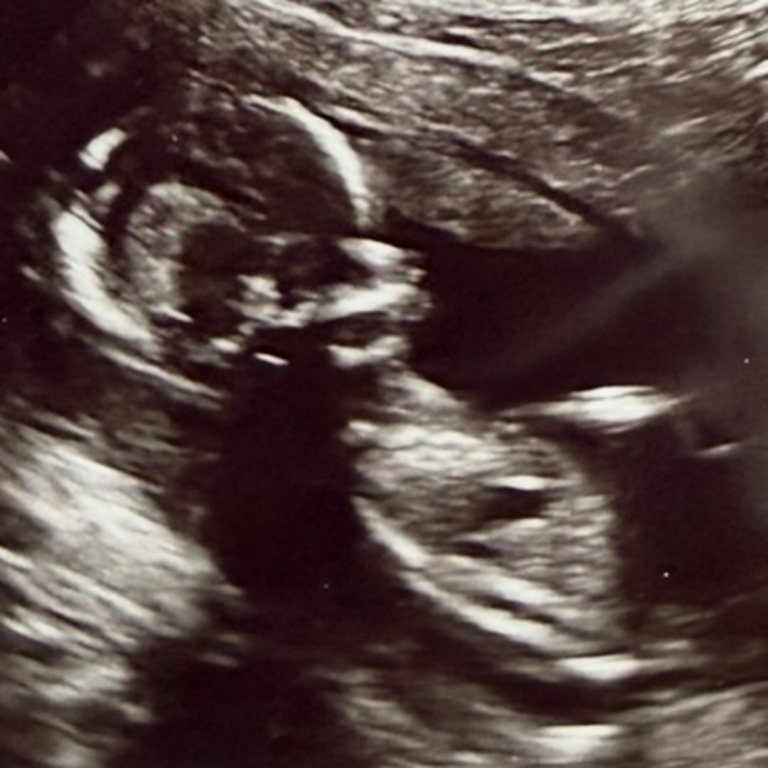 Photo shared by Abby Rose for their Babylist baby registry.