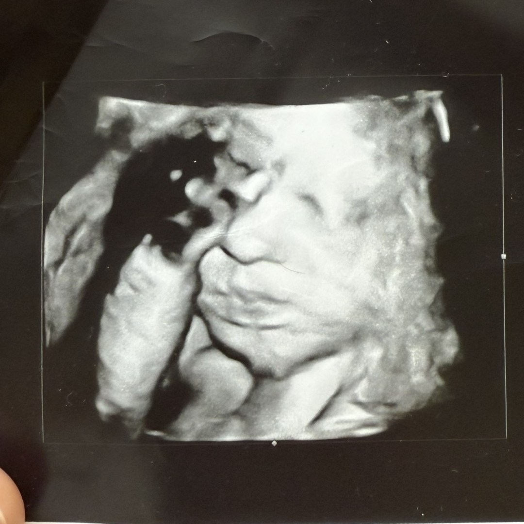 Photo shared by Karlee for their Babylist baby registry.