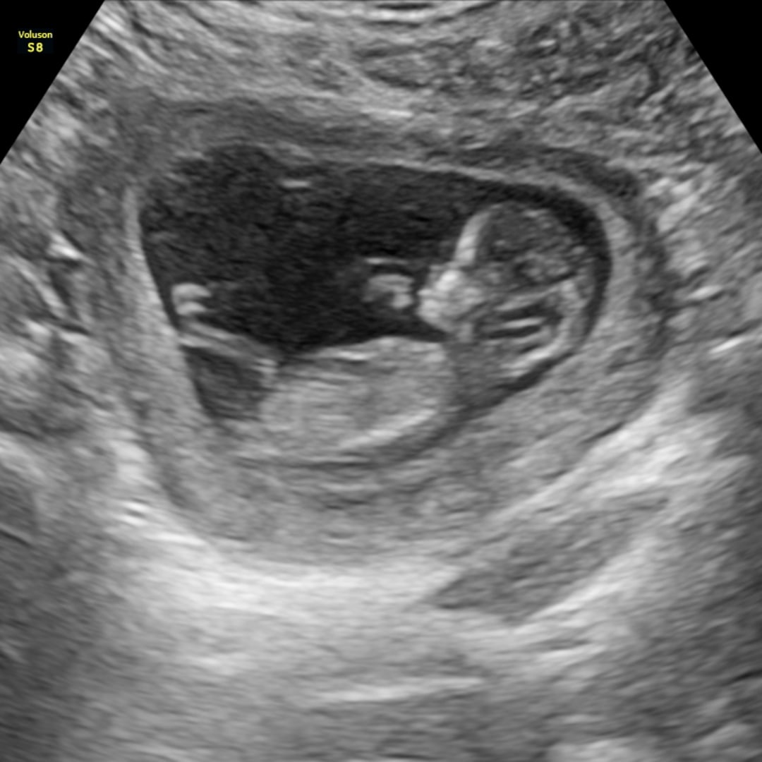 Photo shared by Hayley for their Babylist baby registry.