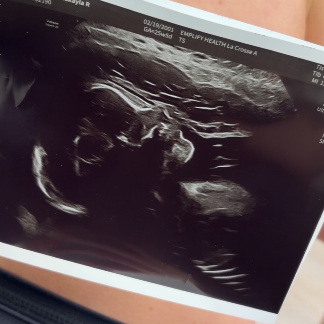 Photo shared by Makayla for their Babylist baby registry.