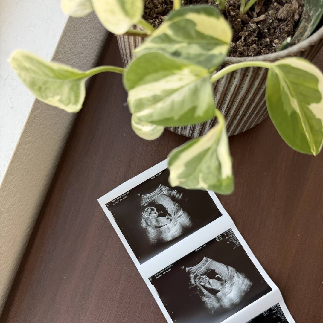 Photo shared by Emma for their Babylist baby registry.