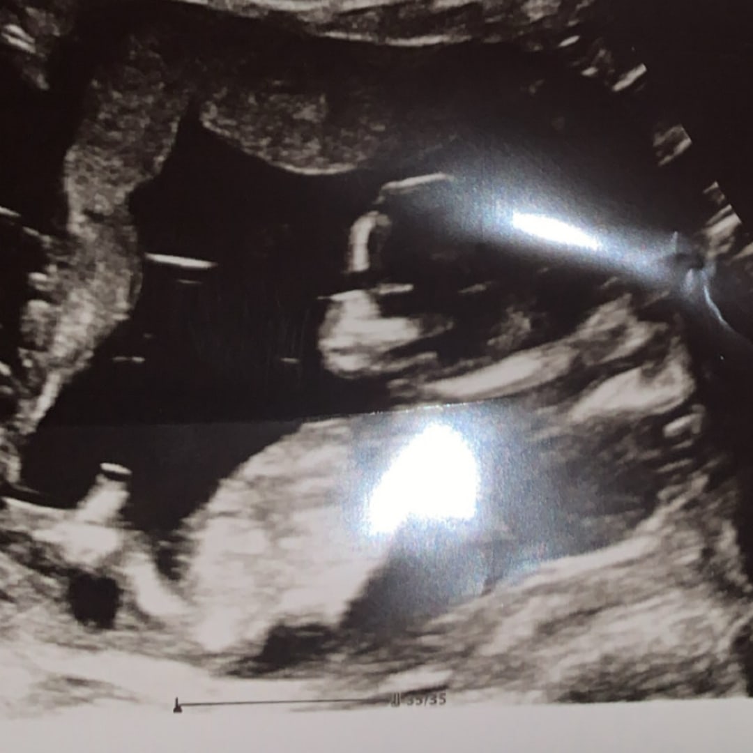 Photo shared by Emily for their Babylist baby registry.