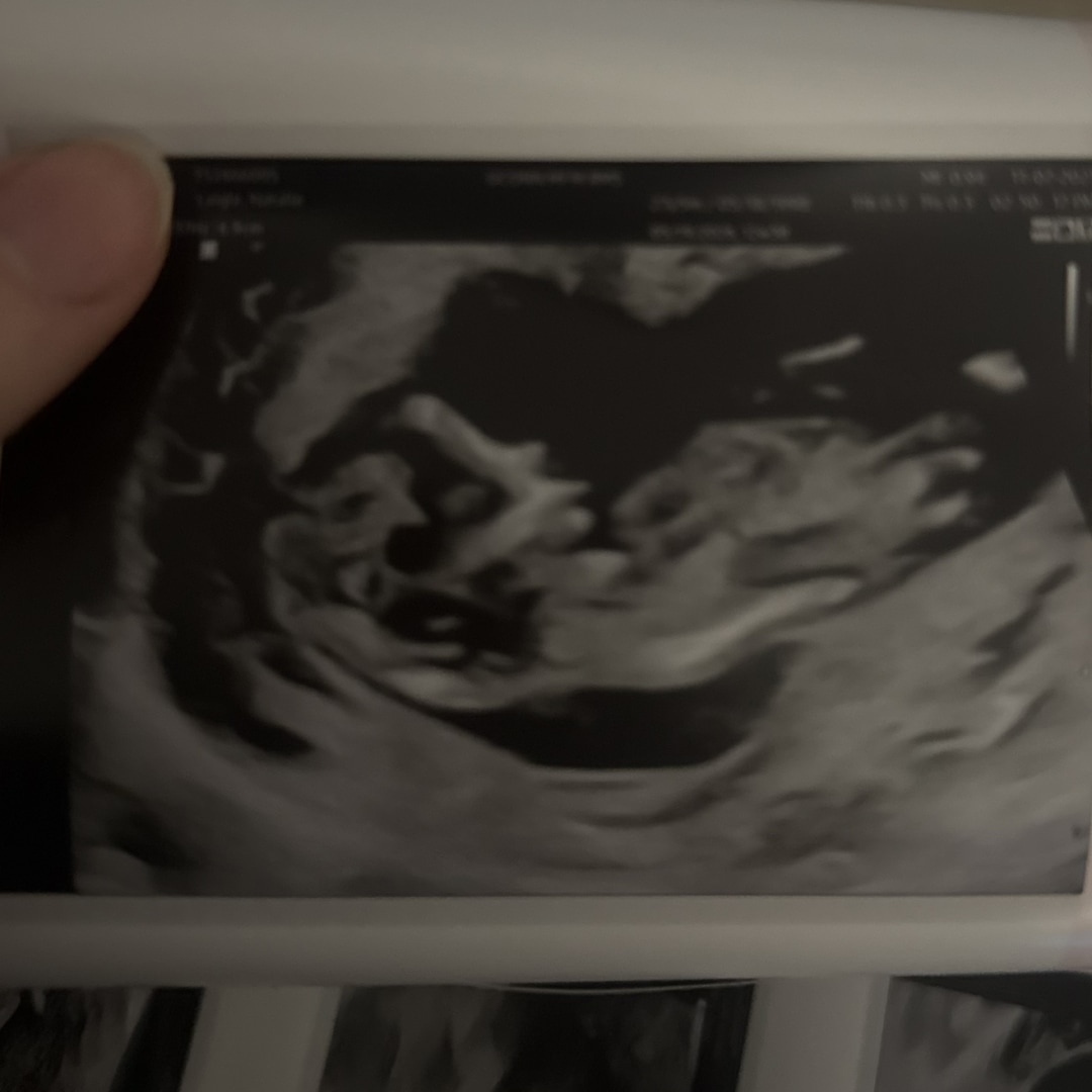 Photo shared by Natalie for their Babylist baby registry.