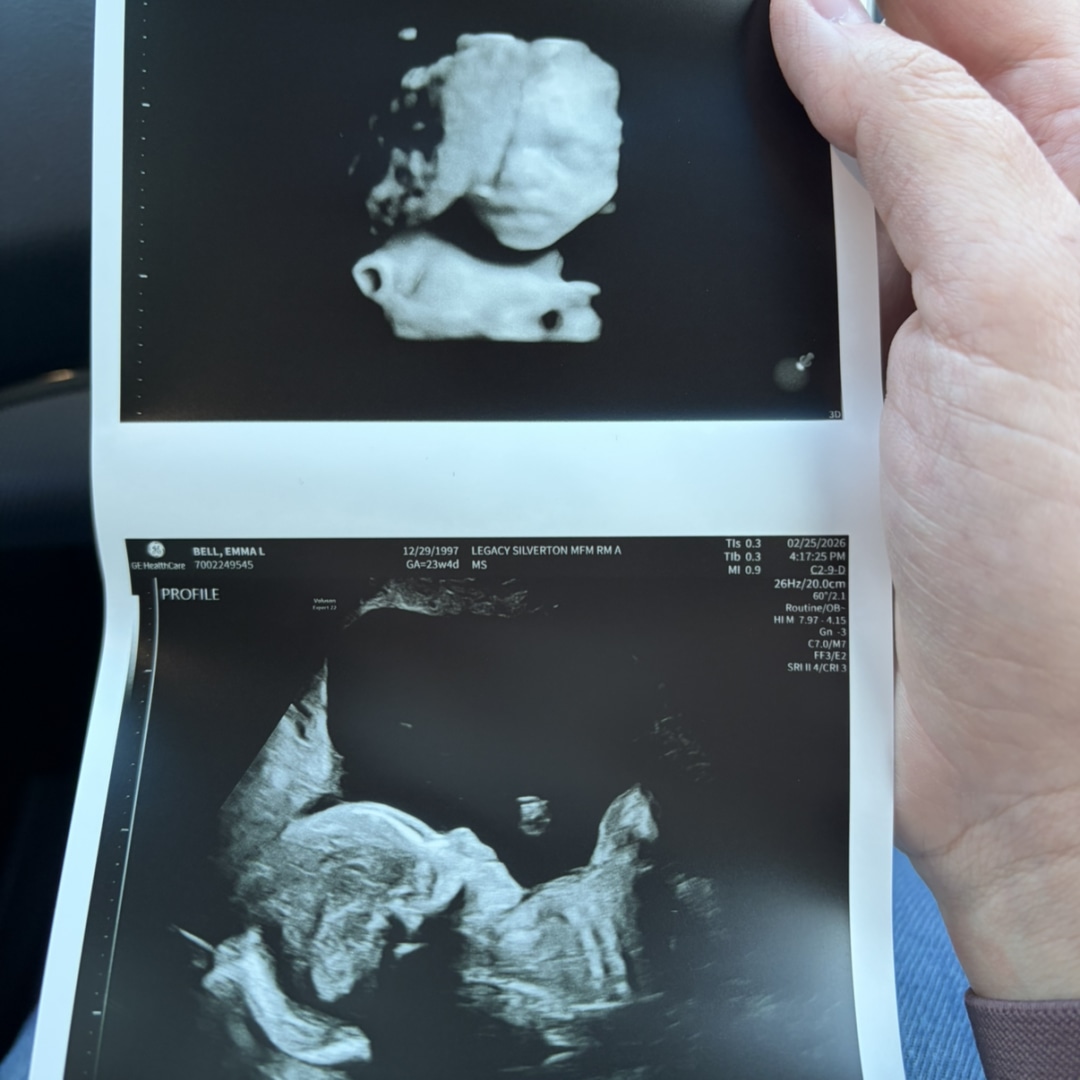 Photo shared by Emma for their Babylist baby registry.