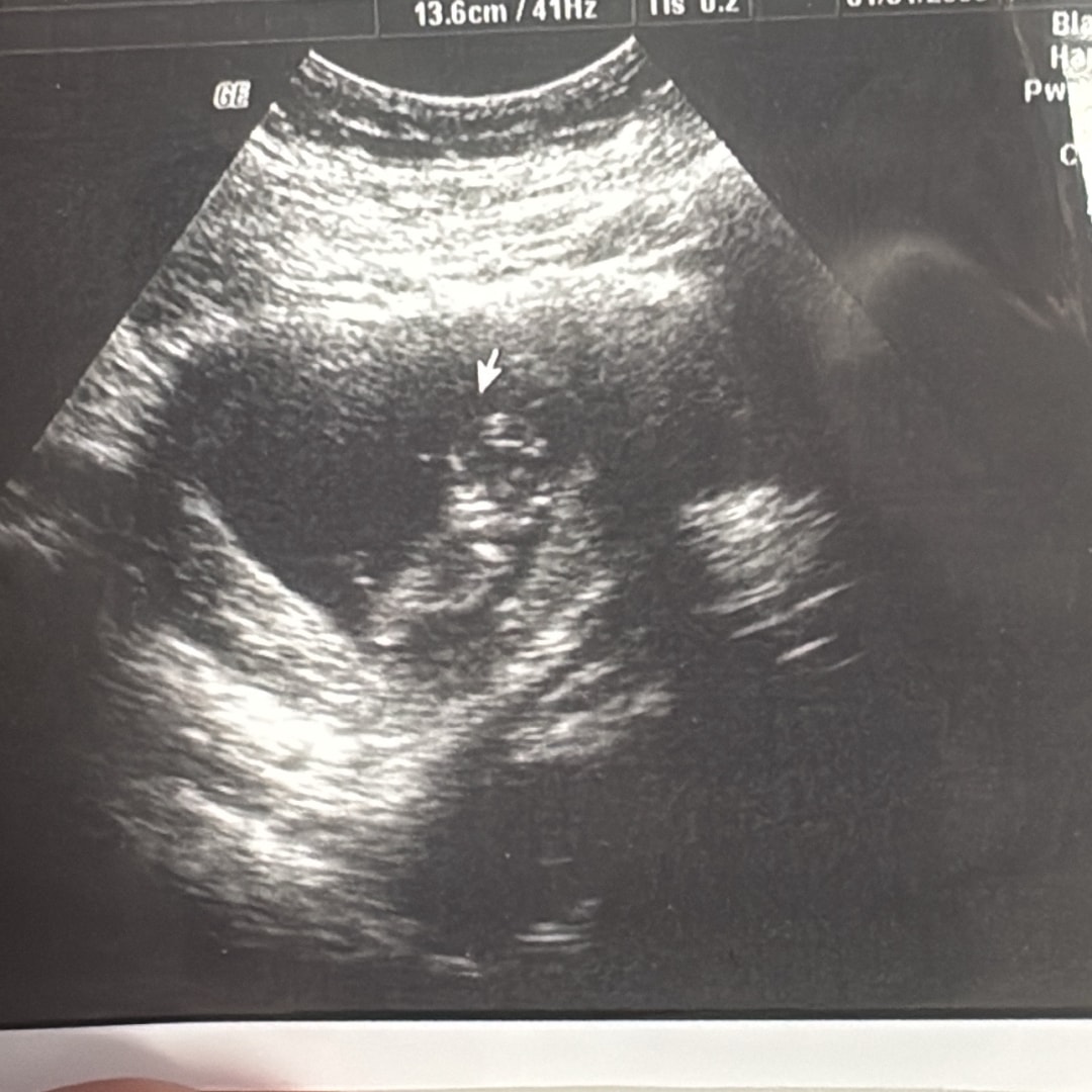 Photo shared by Heidi for their Babylist baby registry.