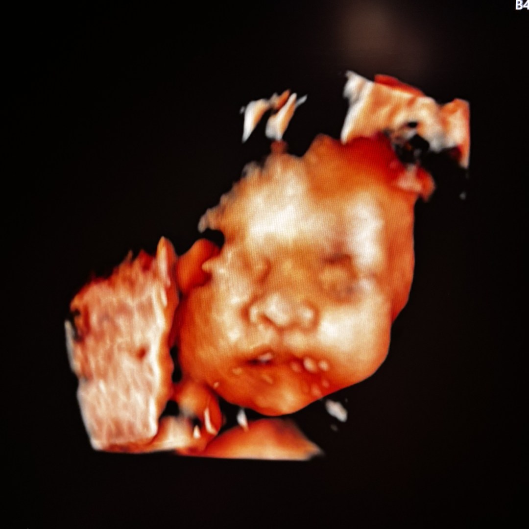 Photo shared by Ana for their Babylist baby registry.