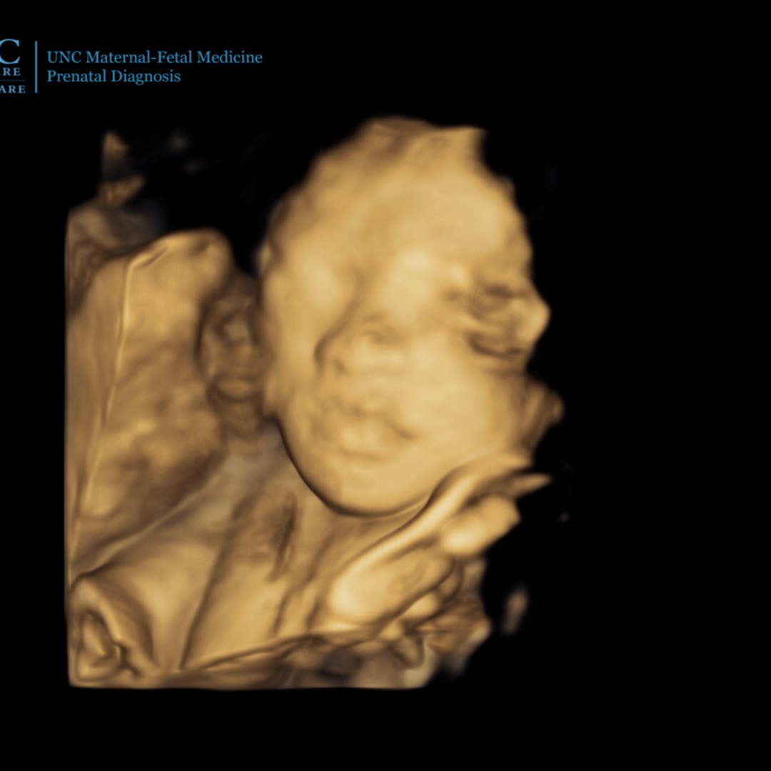 Photo shared by Brittany for their Babylist baby registry.