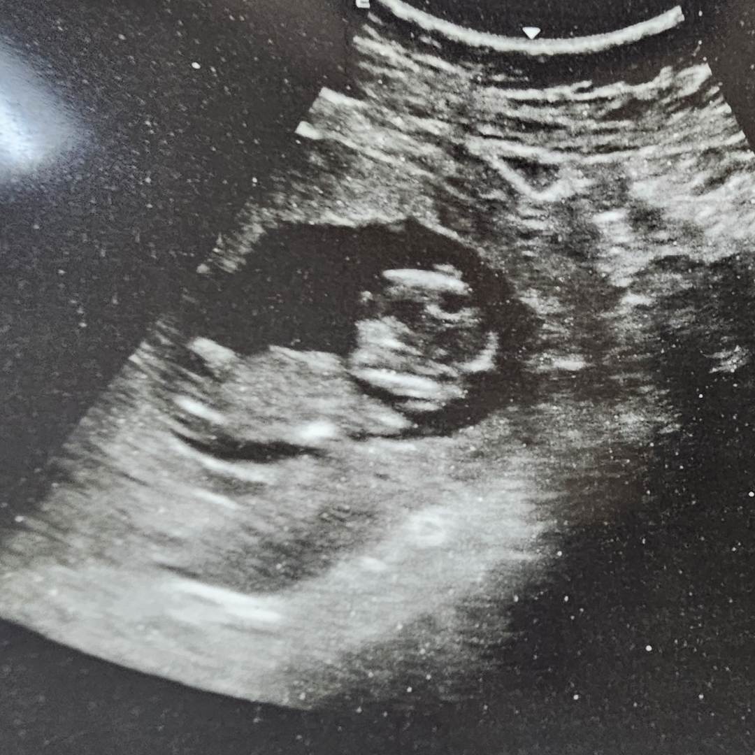Photo shared by Christa for their Babylist baby registry.