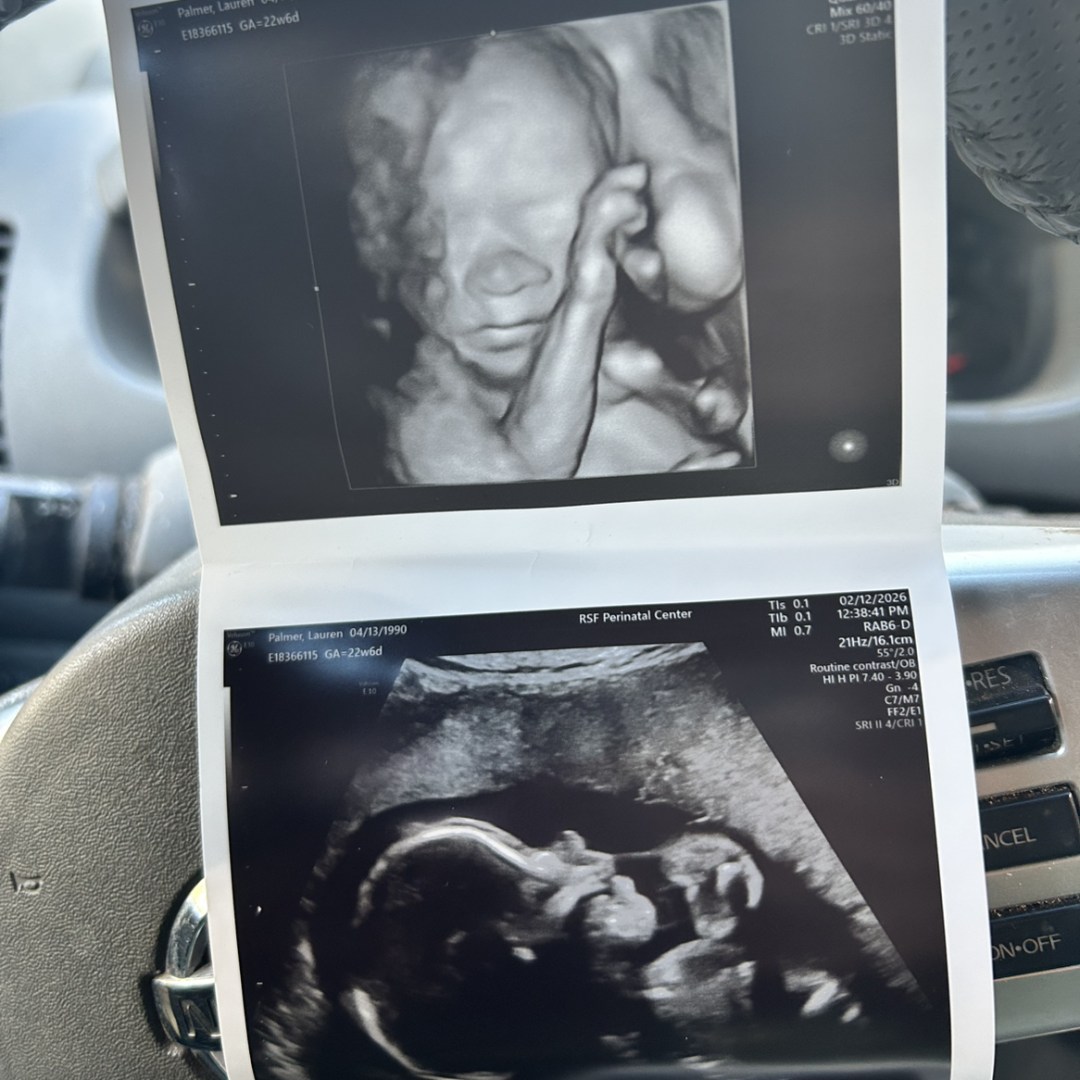 Photo shared by Lauren for their Babylist baby registry.