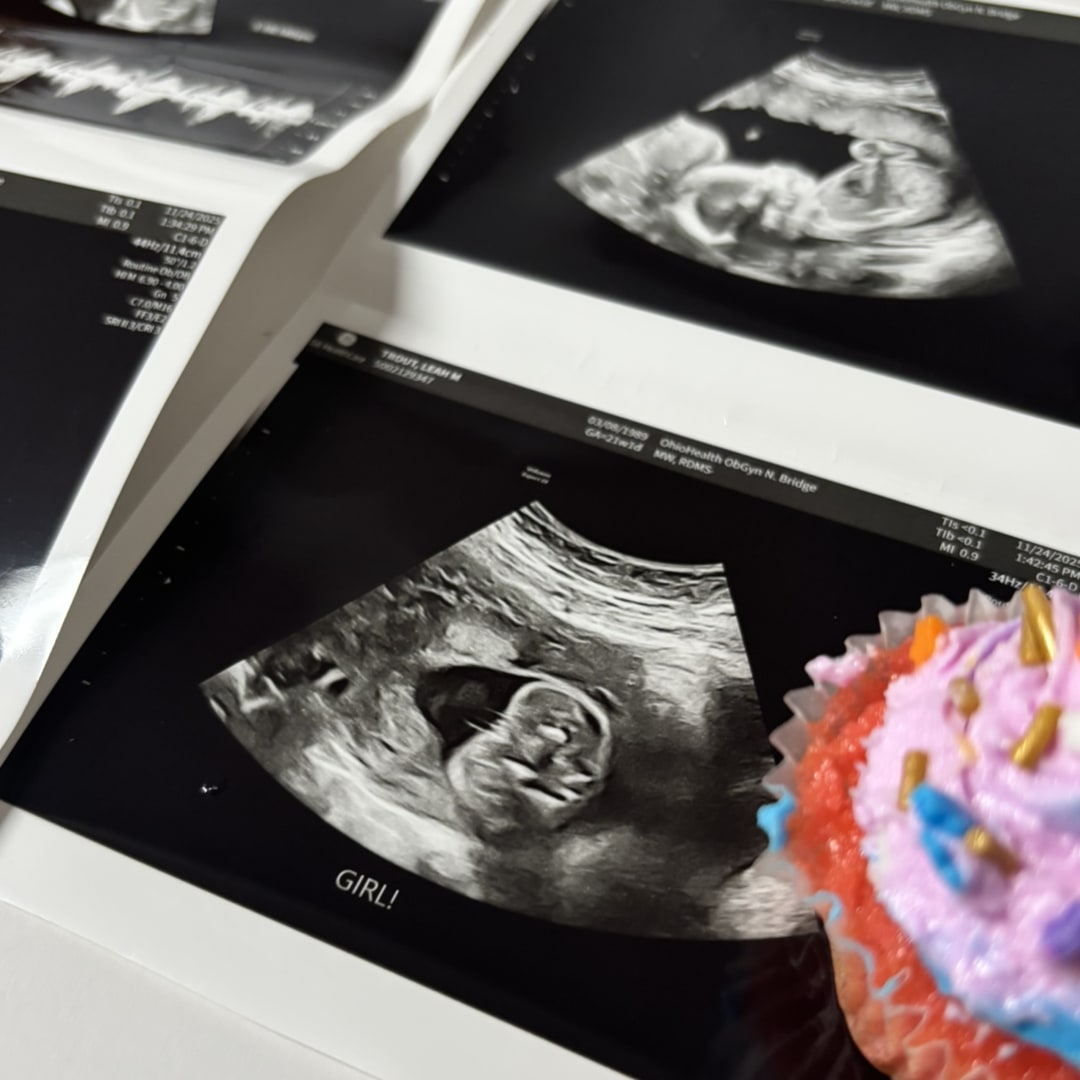 Photo shared by Leah for their Babylist baby registry.