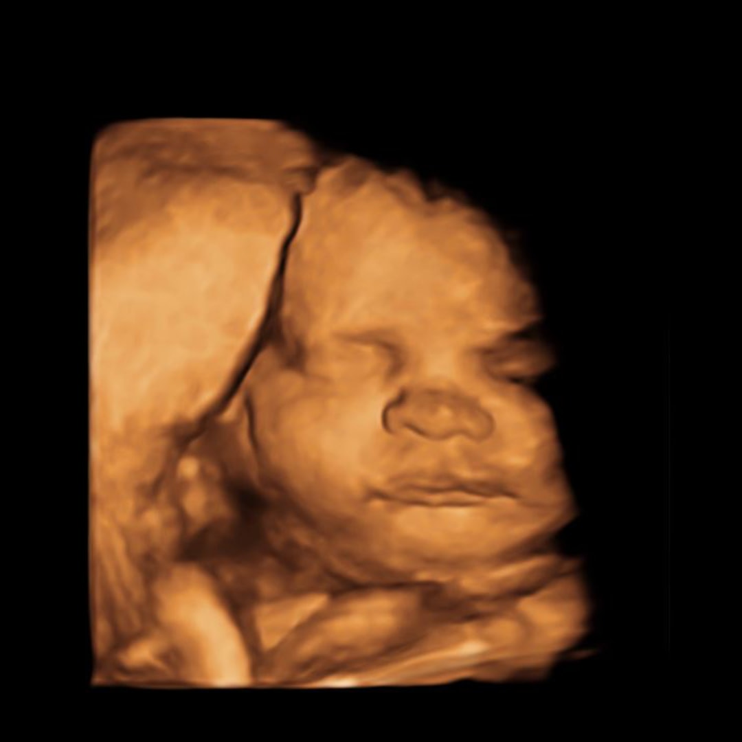 Photo shared by Miranda and Devin for their Babylist baby registry.