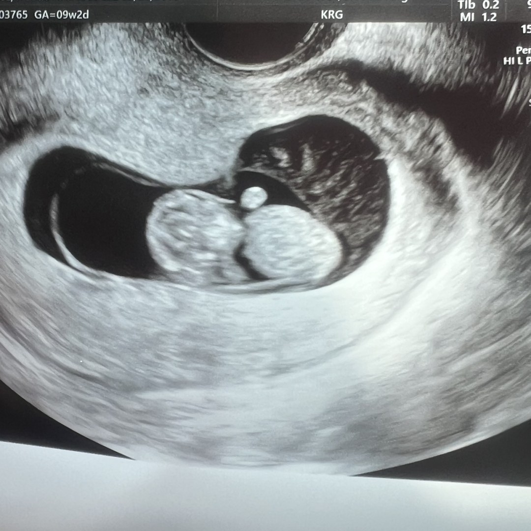 Photo shared by Lexi for their Babylist baby registry.