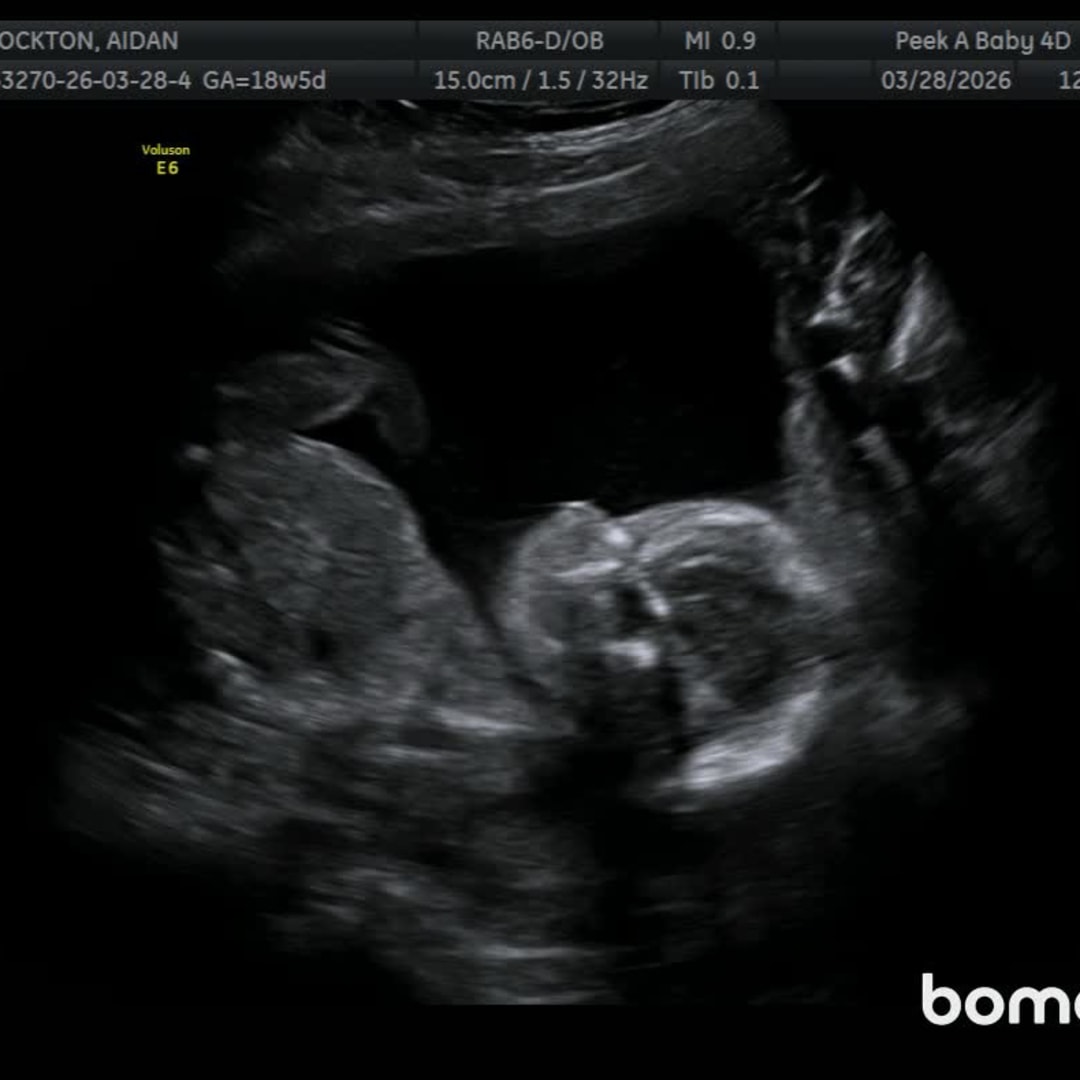 Photo shared by Aidan for their Babylist baby registry.