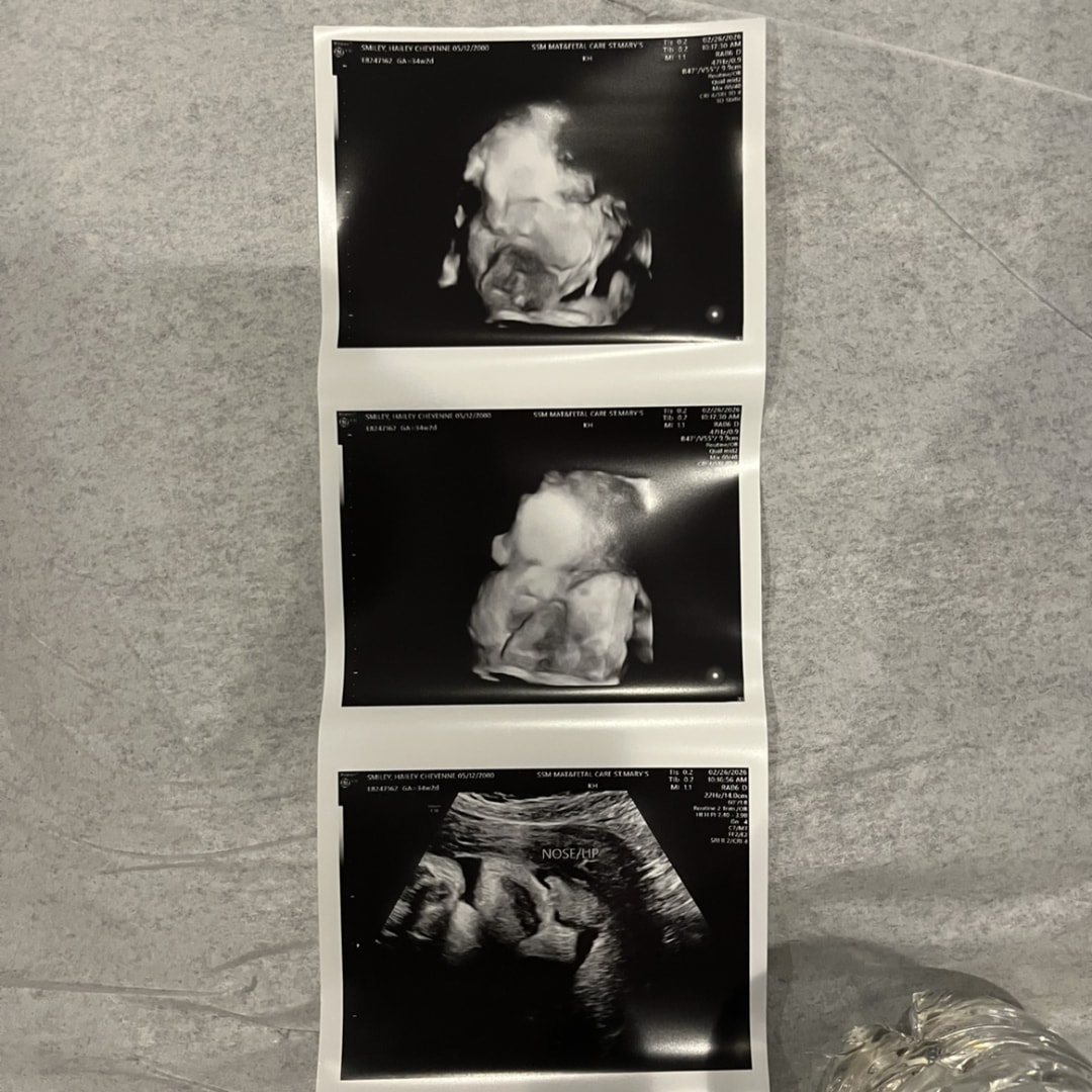 Photo shared by Hailey for their Babylist baby registry.