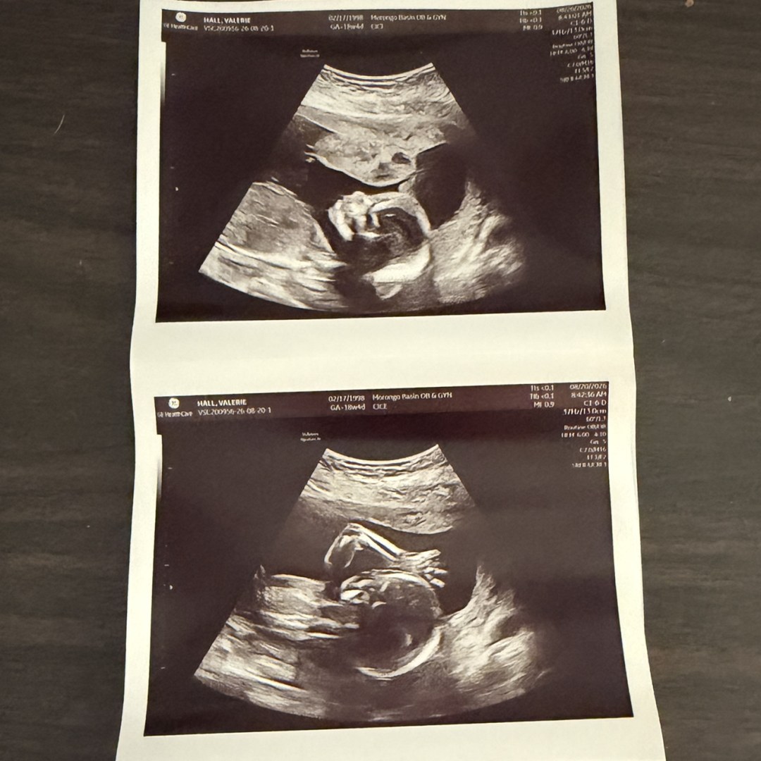 Photo shared by Valerie for their Babylist baby registry.
