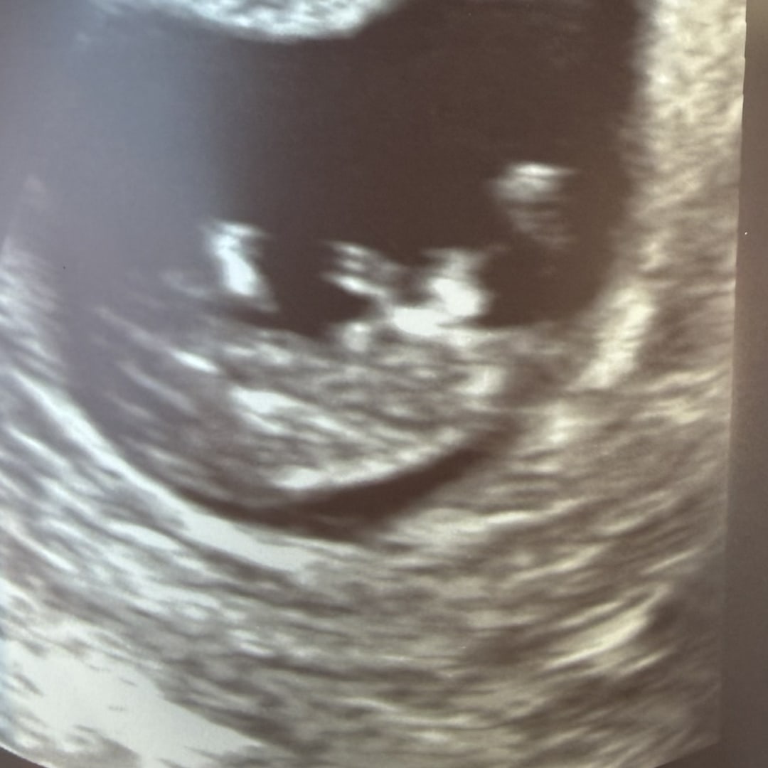 Photo shared by Ana for their Babylist baby registry.