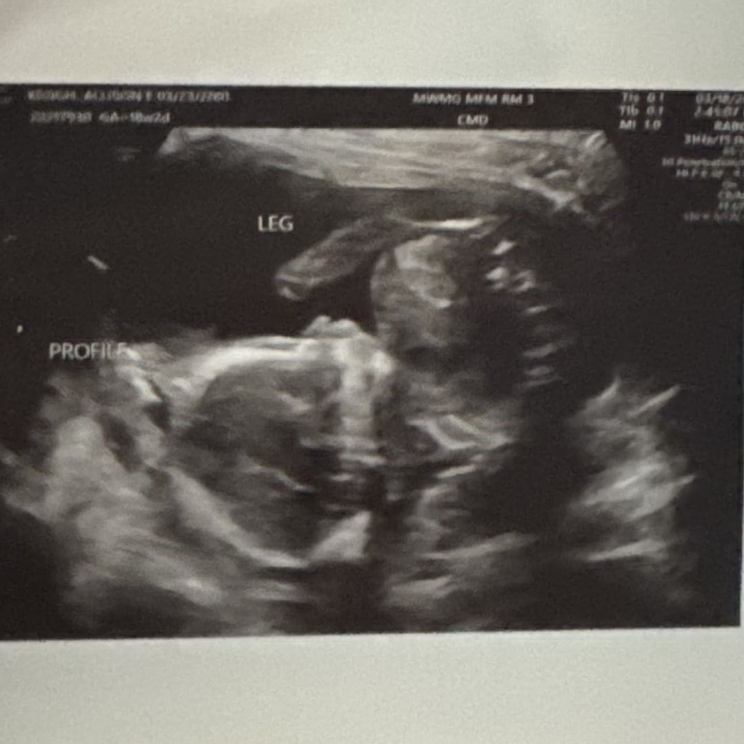 Photo shared by Ally for their Babylist baby registry.