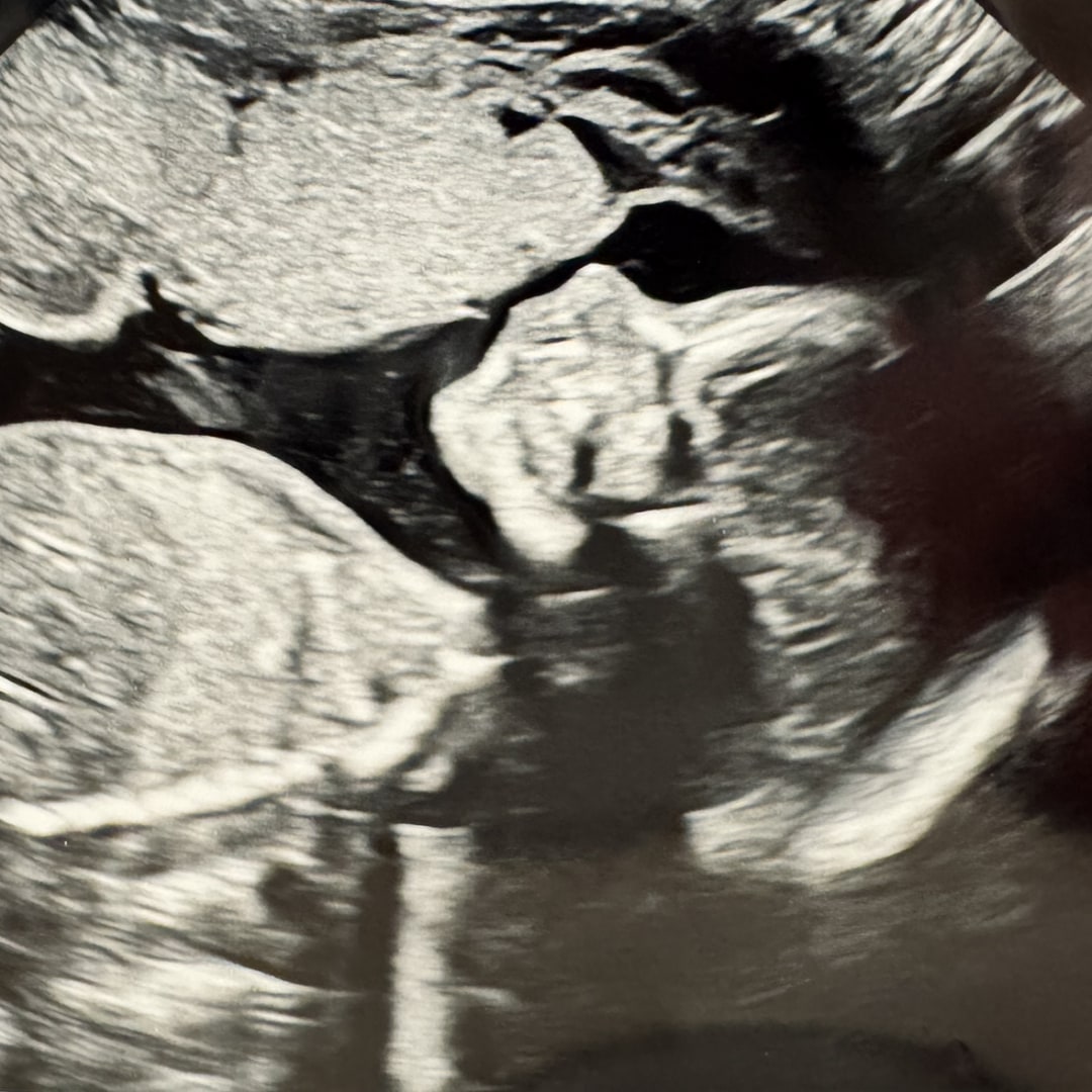 Photo shared by Sarah for their Babylist baby registry.