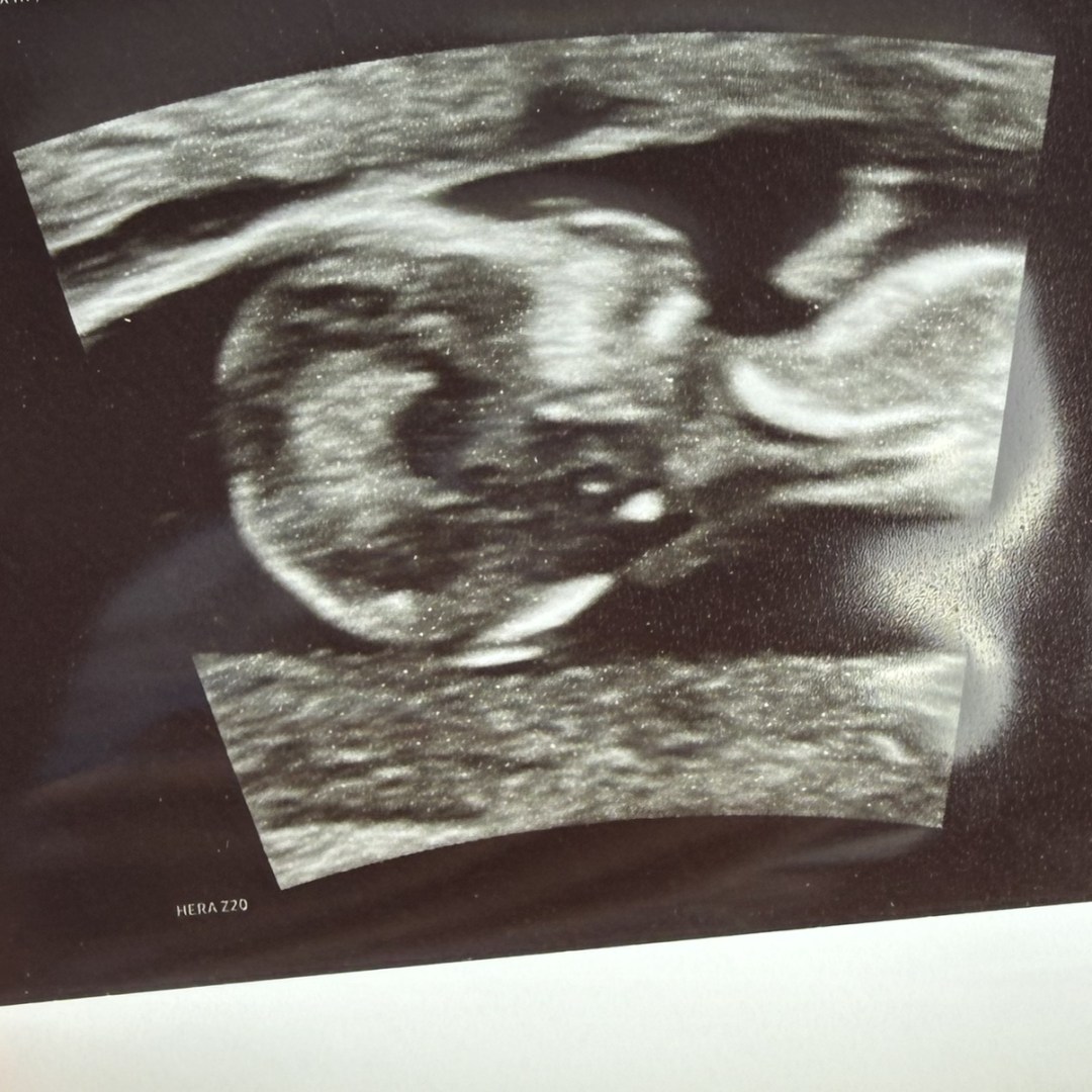 Photo shared by Naomi for their Babylist baby registry.