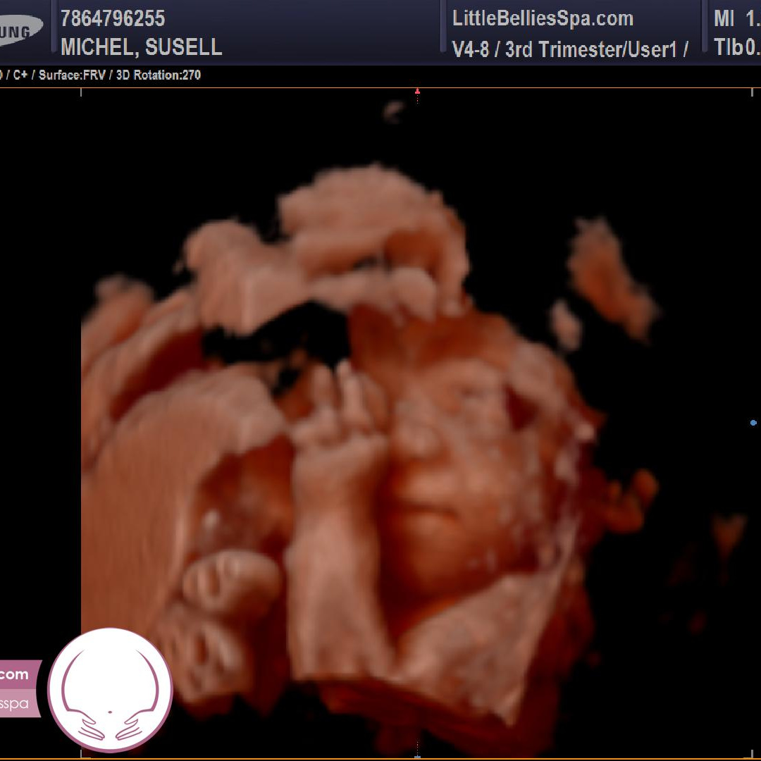 Photo shared by Susie & David for their Babylist baby registry.