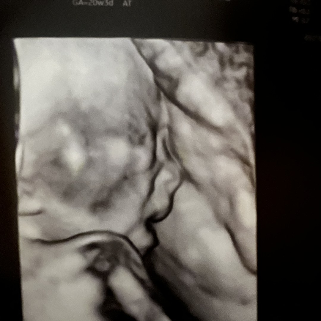 Photo shared by Tyler for their Babylist baby registry.