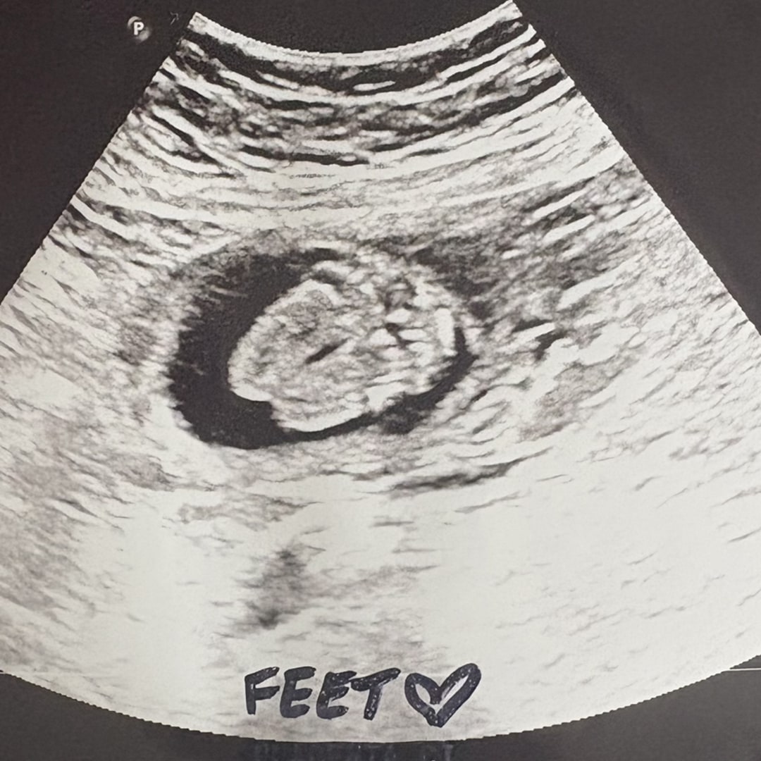 Photo shared by Carrie for their Babylist baby registry.