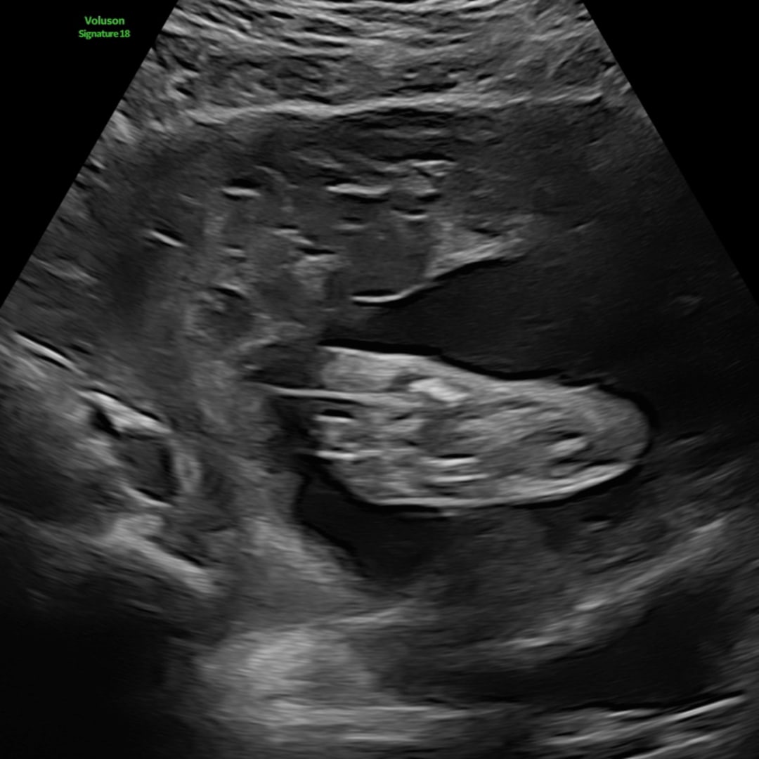 Photo shared by Fuiono for their Babylist baby registry.