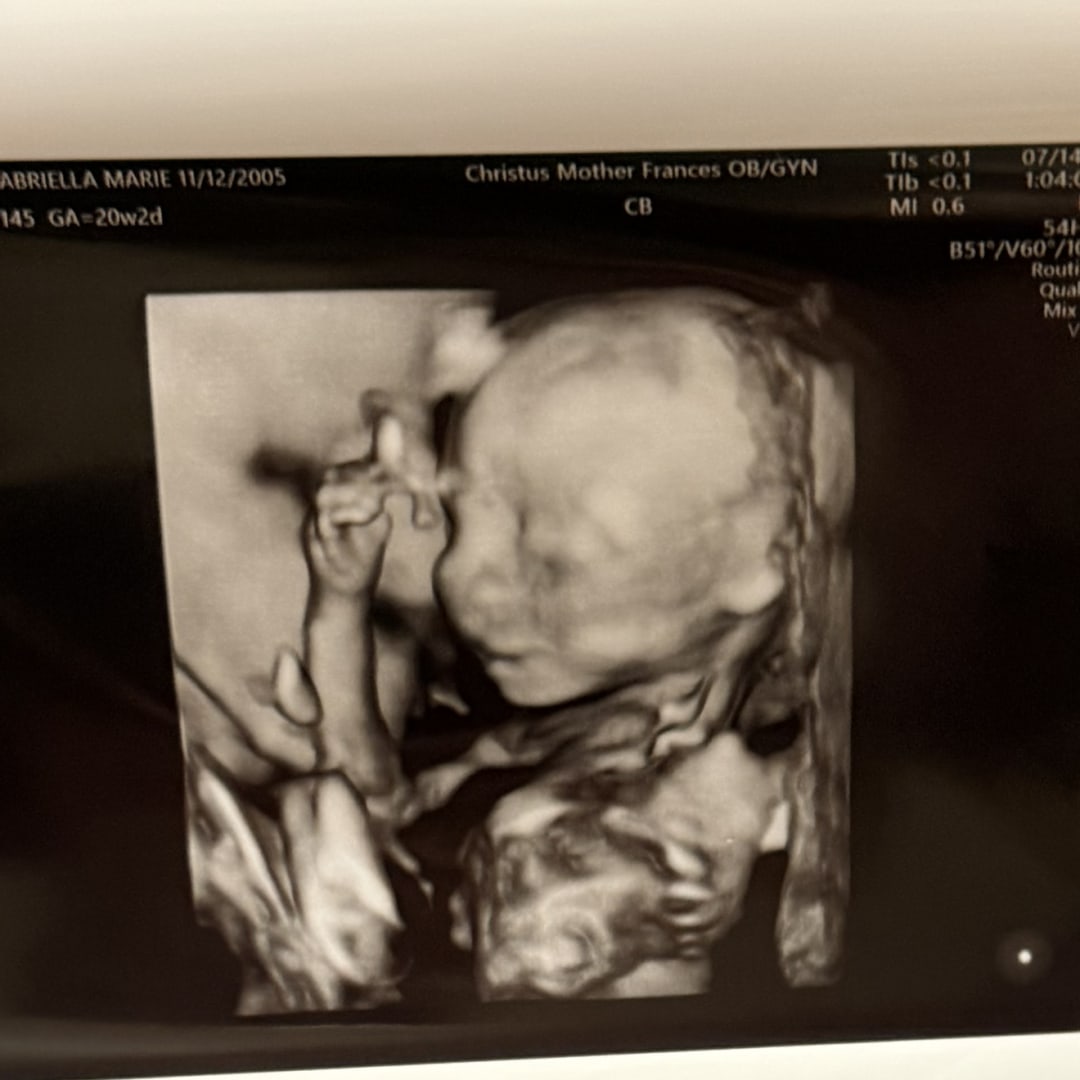 Photo shared by Gabriella for their Babylist baby registry.