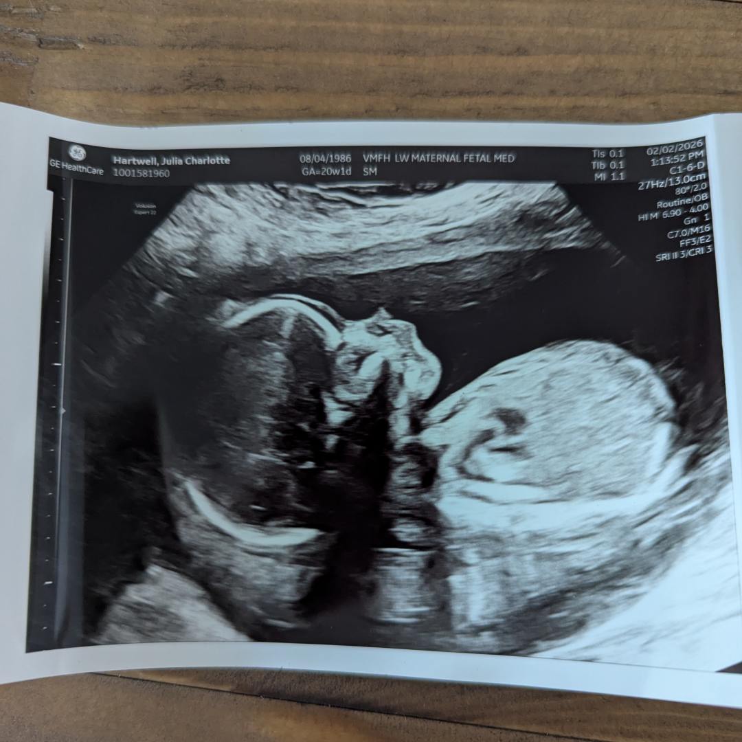 Photo shared by Julia for their Babylist baby registry.