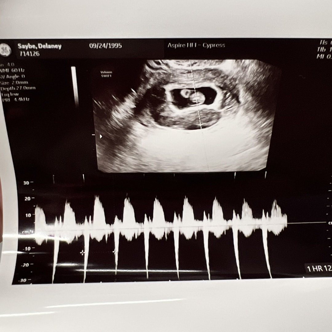 Photo shared by Delaney for their Babylist baby registry.