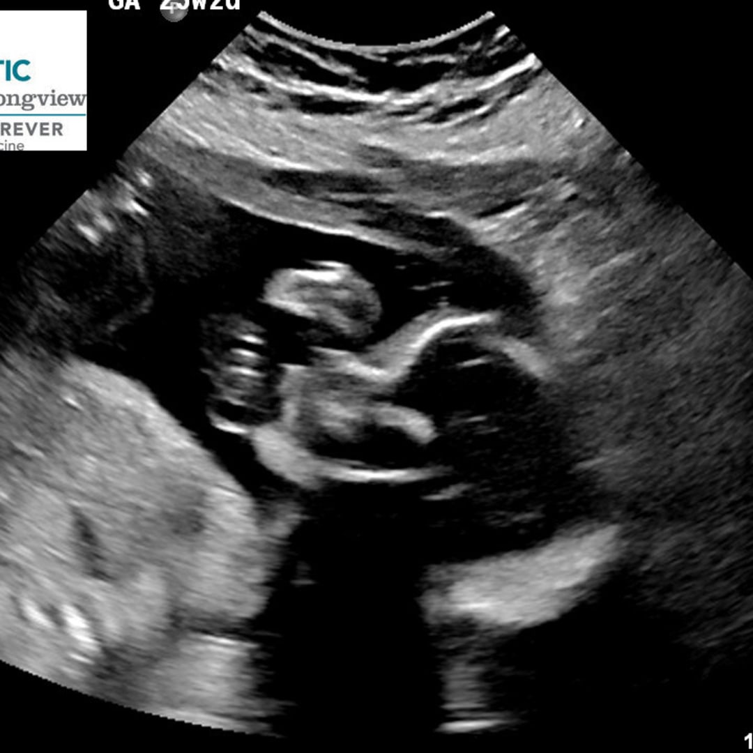 Photo shared by Alexis for their Babylist baby registry.