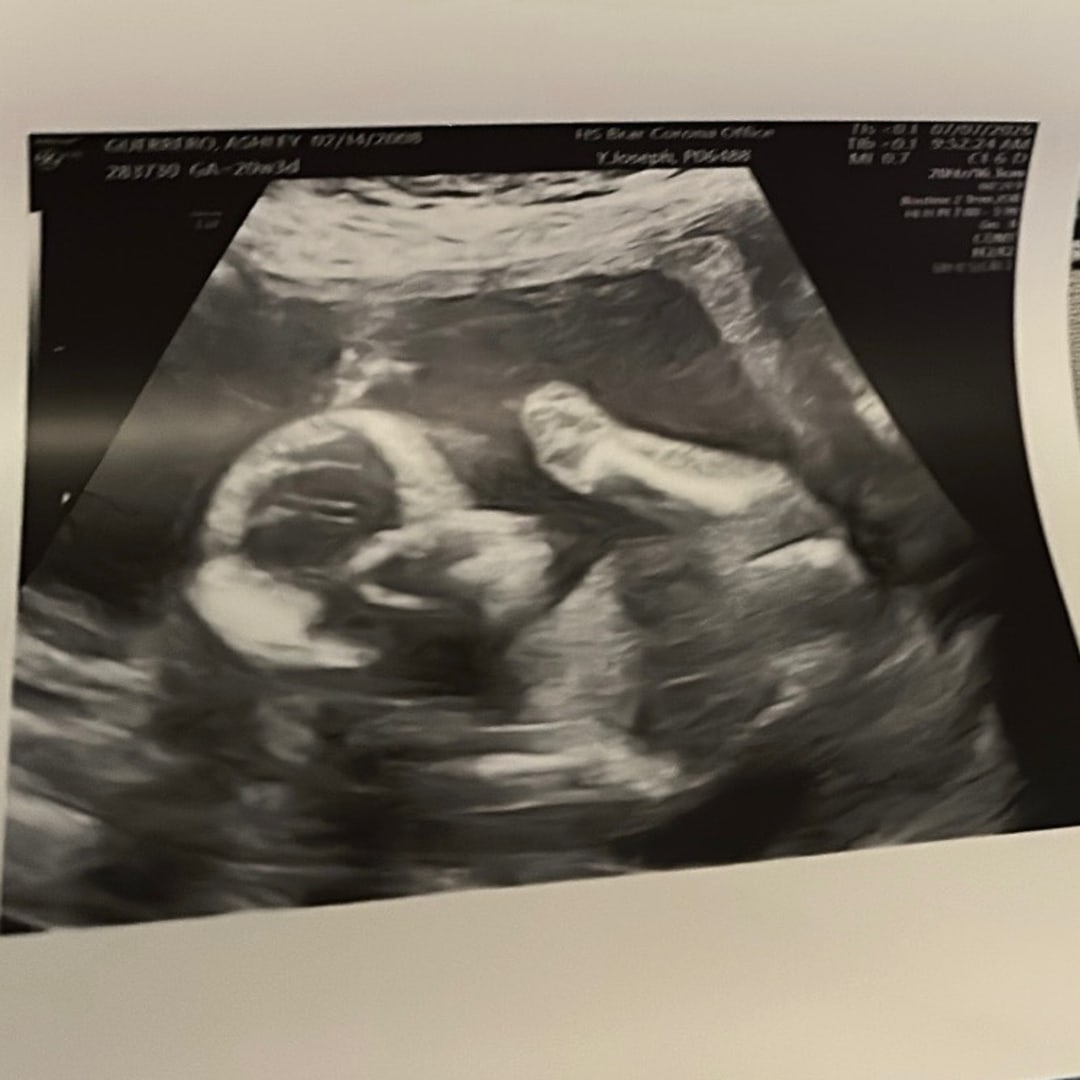 Photo shared by Alicia for their Babylist baby registry.