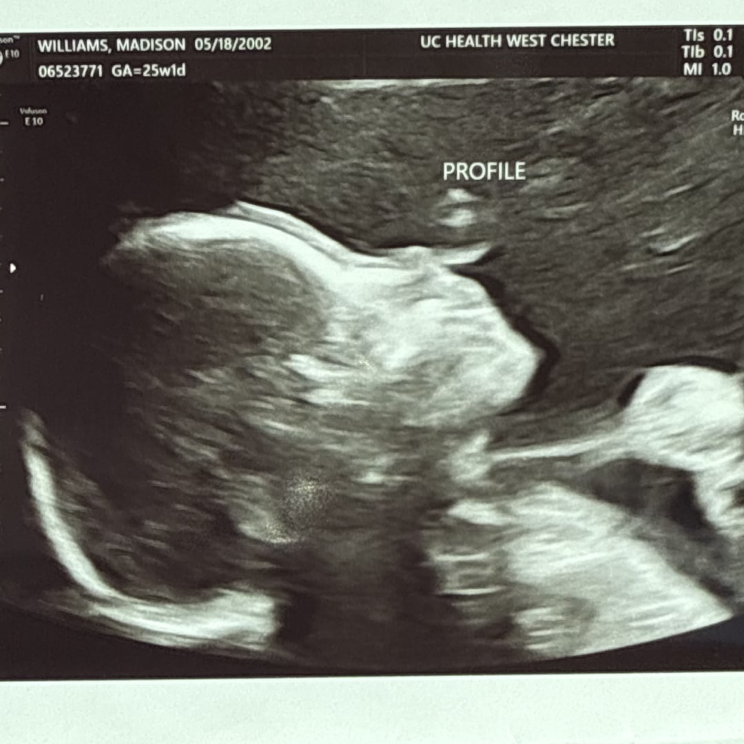 Photo shared by Madison for their Babylist baby registry.