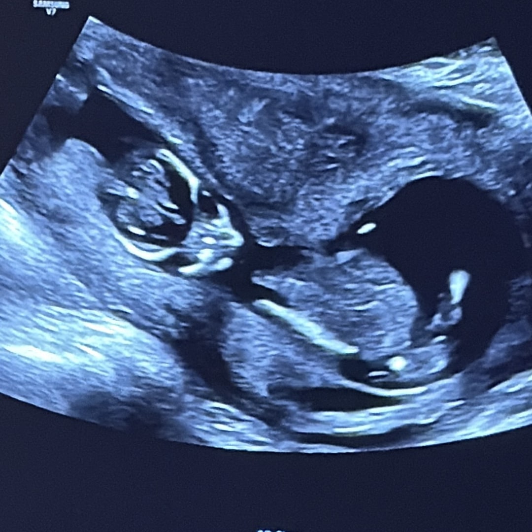 Photo shared by Hannah for their Babylist baby registry.