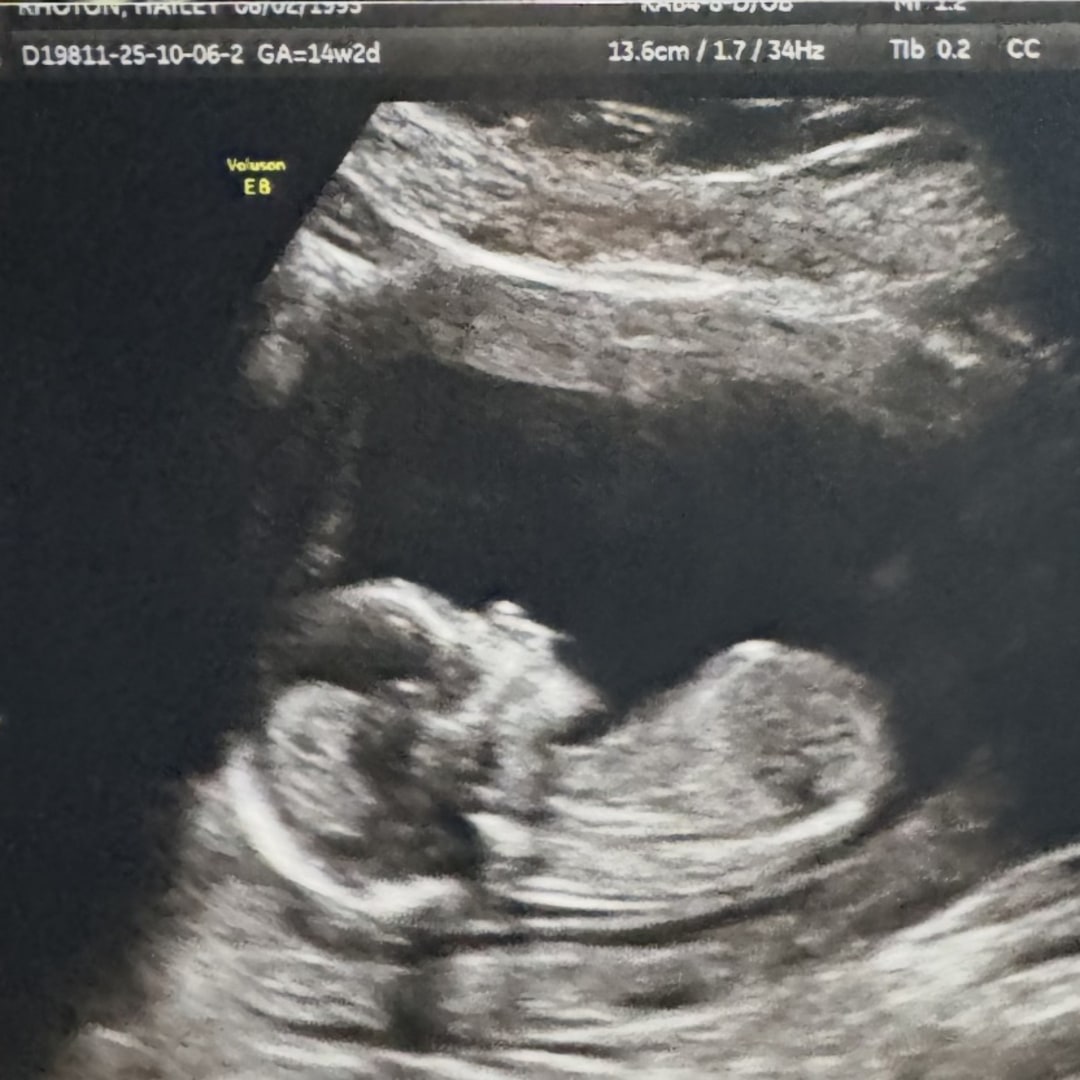 Photo shared by Hailey for their Babylist baby registry.